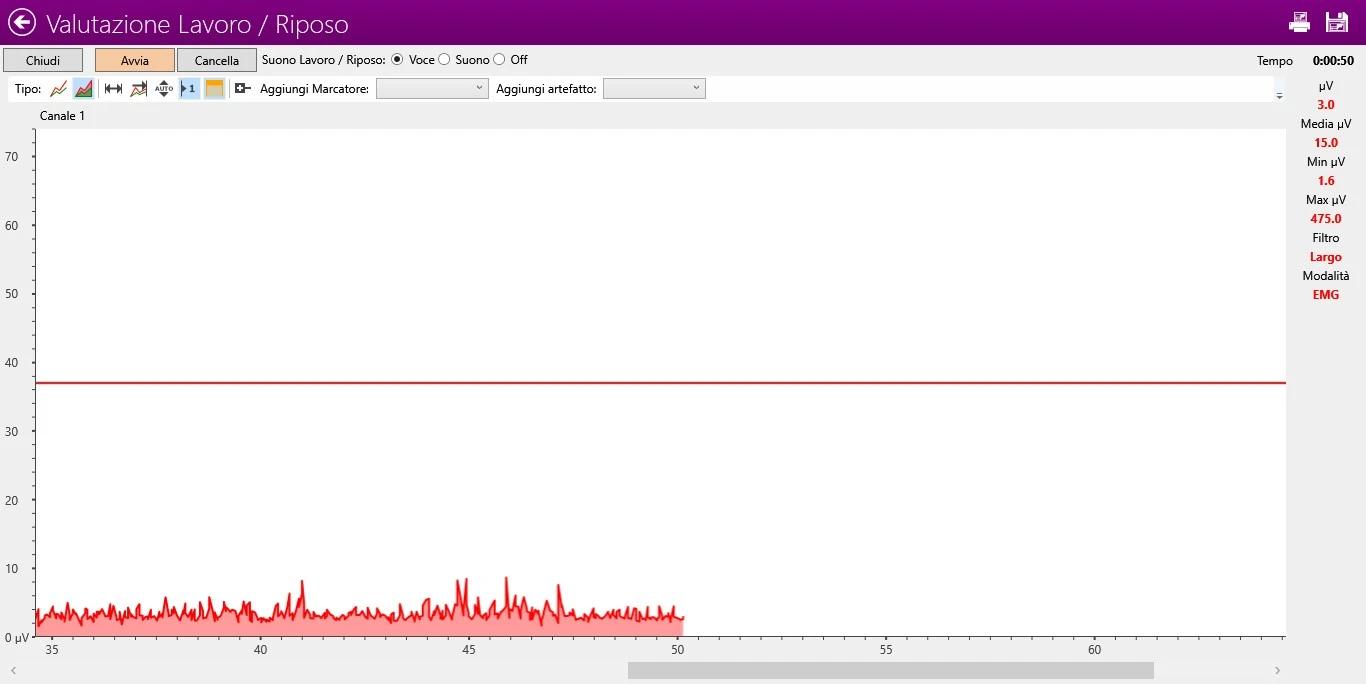 Immagine del software utilizzato per l'Elettrostimolazione Pavimento Pelvico